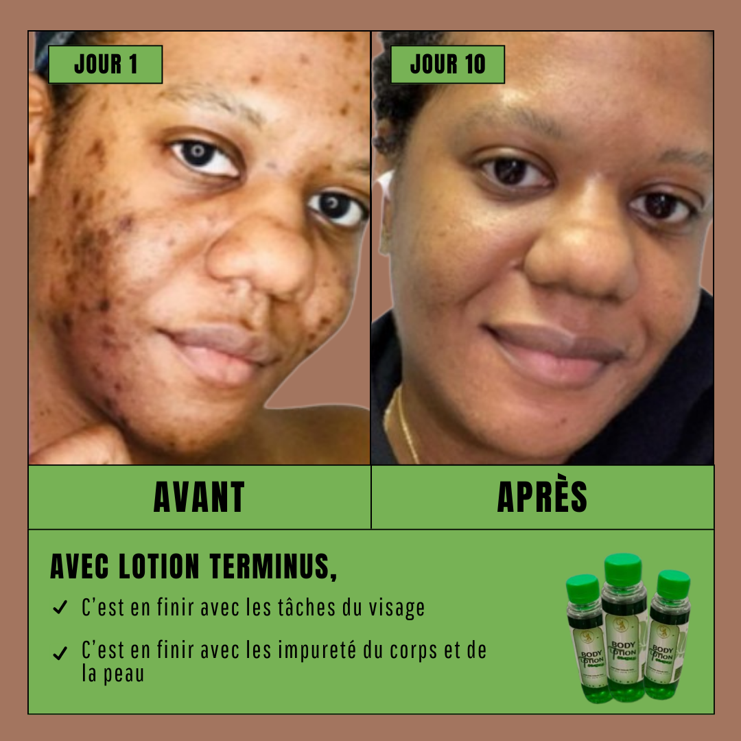 Lotion Terminus
