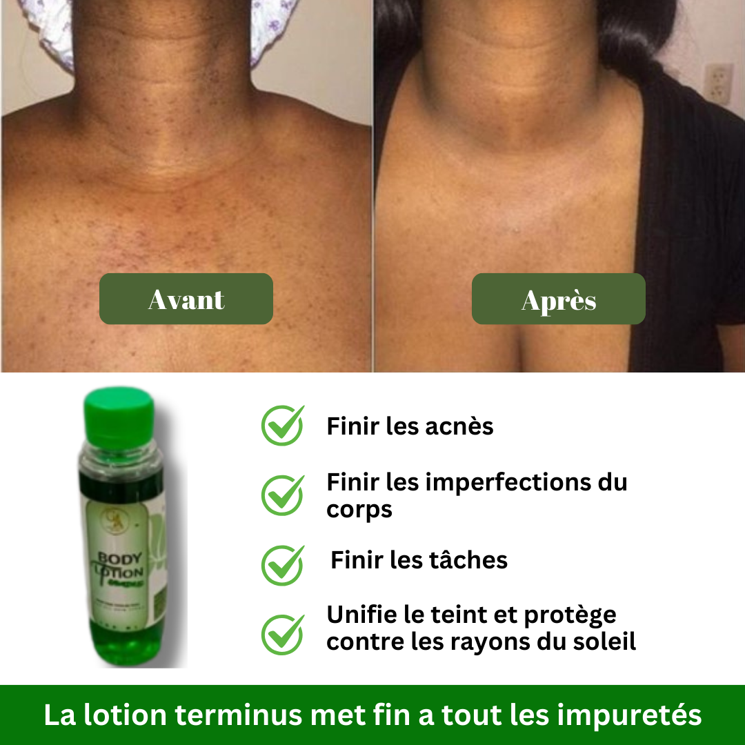 Lotion Terminus