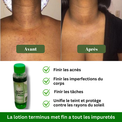 Lotion Terminus